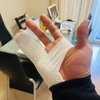 アナタが噛んでないのに小指がイタイ