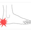 What Are The Major Causes Of Heel Pains