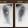 ECG-131：answer