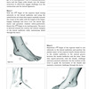 Hammer Toe Pain When Taking Walks