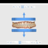MeditスキャナーとMeditLinkソフトウェアの紹介⑤Medit App 模型作り！Model Builder 2022 8月7日更新