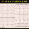 ECG-212：answer-1/2:俯瞰的に読む