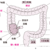 盲腸の手術で生理痛。