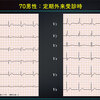 ECG-356：V1の高いR波を見たら。。= 心電図検定試験：傾向と対策 Q.004 =