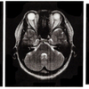 初めてのMRI