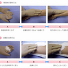 創傷ケア(スキン　テア、褥瘡、下肢潰瘍)を科学する③～スキンテア予防の基本とケア用品の選び方