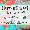 異所性蒙古斑のレーザー治療無事終了