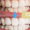 東京のホワイトニング専門歯科【ホワイトマイスター】