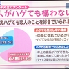 恋人がハゲても構わない？夫なら構う。