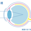 近視って