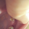 斜歯の支え部分