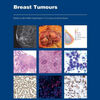 Free download books from amazon Breast Tumours / Edition 5 in English