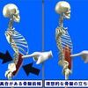 骨盤前傾による内臓ダメージなどにつきまして