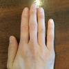 ボルダリングによる指の痛みを治すには？超音波治療器がおすすめ。