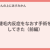 睫毛内反症をなおす手術をしてきた（前編）