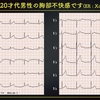 ECG-243：20才代男性。深夜に胸痛が生じてERへ。