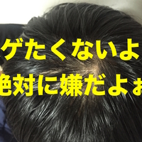 ハンターハンター プロハンター 意外とハゲが多くてハゲほど有能説 私の名前はジロギン ハンターハンター プロハンター 意外とハゲが多くてハゲほど有能説 私の名前はジロギン