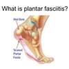 What Exactly Leads To Plantar Fasciitis