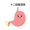 十二指腸潰瘍に関する雑学