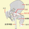 お尻ほっぺ、くぼみの痛み