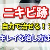 ニキビ跡は自力で治せる！？キレイな治し方はコレ！