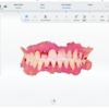SHINING3DのIOS、INTRAORALSCAN V3.6.5.Xアップデート