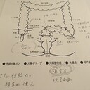 大腸憩室炎 ブログ