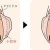 ＜Q&Aシリーズ＞婦人科形成（小陰唇縮小、クリトリス包茎手術）