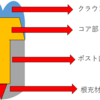 歯内療法関連材料のツボ④「支台築造材料のツボ２回目」