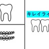 歯をキレイに保つために必要な最低限の道具's