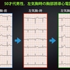 ECG-198：answer