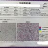 D24 人工授精（AIH）2回目