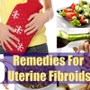 NATURAL REMEDIES FOR FIBROIDS