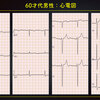 ECG-324：answer(2/2)