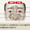 副鼻腔炎をいつ疑うか。感度と特異度