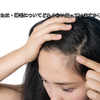 あなたは、薄毛についてどれくらい知っていますか?