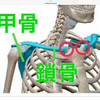 緊急寝違え治療