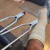 【3日目】アキレス腱断裂
