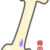 骨肉腫に関する雑学