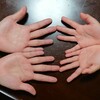 両手ますかけ線が身近に２人！右手が変形ますかけ線も１人！遺伝なの？