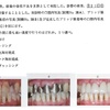 114回　歯冠補綴学振り返り　陶材焼付け鋳造冠製作手順