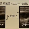 認知症発症を加速させる要因