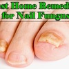 Non Surgical Hammer Toe Treatments