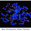 じじぃの「老化時計・がんの発生を予防するテロメア？細胞を読む」