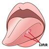 美容を意識した食事をすることで、口内炎の予防や早期治癒が可能です。