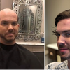 Difference between hair transplant and non-surgical hair replacement