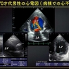 ECG-218：70才代の男性。病棟での呼吸苦発作でした。