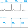 【心拍変動解析の基礎】RR間隔時系列の修正