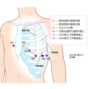心電図 の 付け方