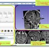 3D slicerのVolume 画像重ねあわせ方